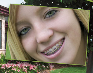 stock photo of a teen girl with braces