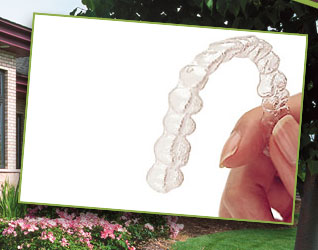 photo of an Invisalign aligner