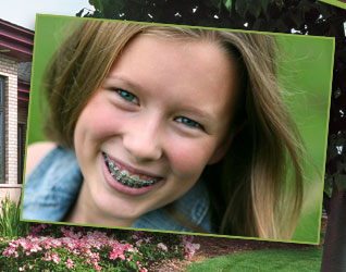 stock photo of a teen girl with braces