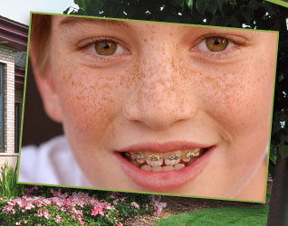 stock photo of a boy with braces