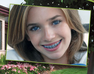 stock photo of a teen girl with braces