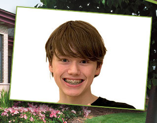 stock photo of a teen boy with braces