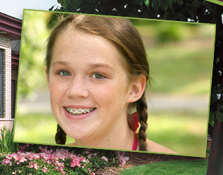 stock photo of a teen girl with braces